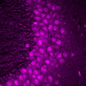 Mapping protein production in brain cells yields new insights for brain disease