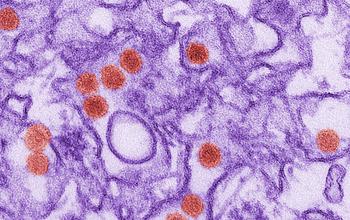 Zika Virus Microscope