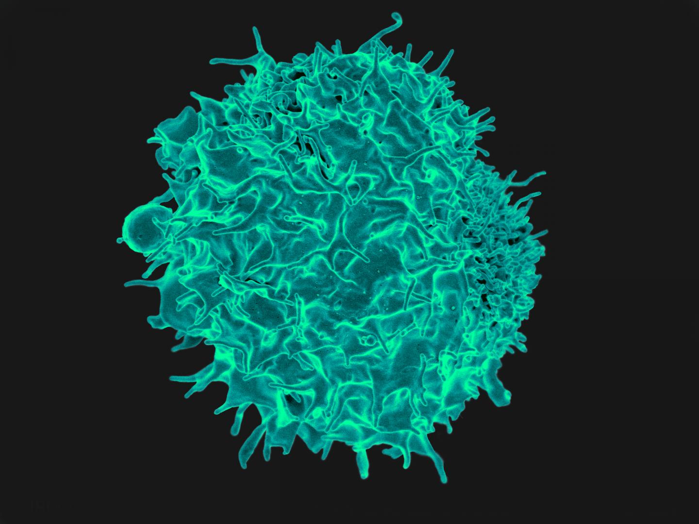 Keeping a Lid on Inflammation