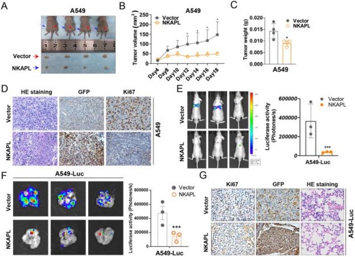 NKAPL suppressed NSCLC growth and metastasis in vivo.