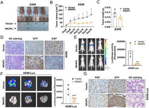 NKAPL suppressed NSCLC growth and metastasis in vivo.