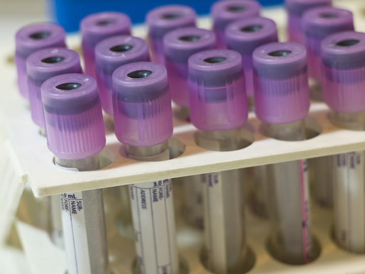 A Blood Test for Autism