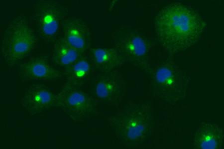 Aggregates of Dysfunctional Proteins
