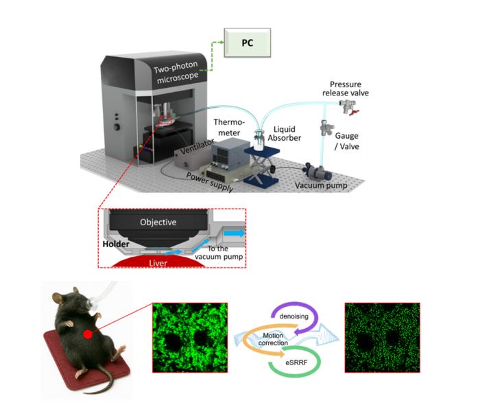 Schematic of suction-based stabilization for super-resolution radial fluctuations