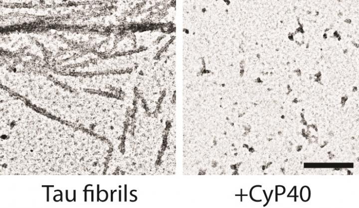 A Human Enzyme Can Reduce Neurotoxic Amyloids in a Mouse Model of Dementia