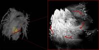 MRI Shows Blood Flow Differs in Men and Women (2 of 2)