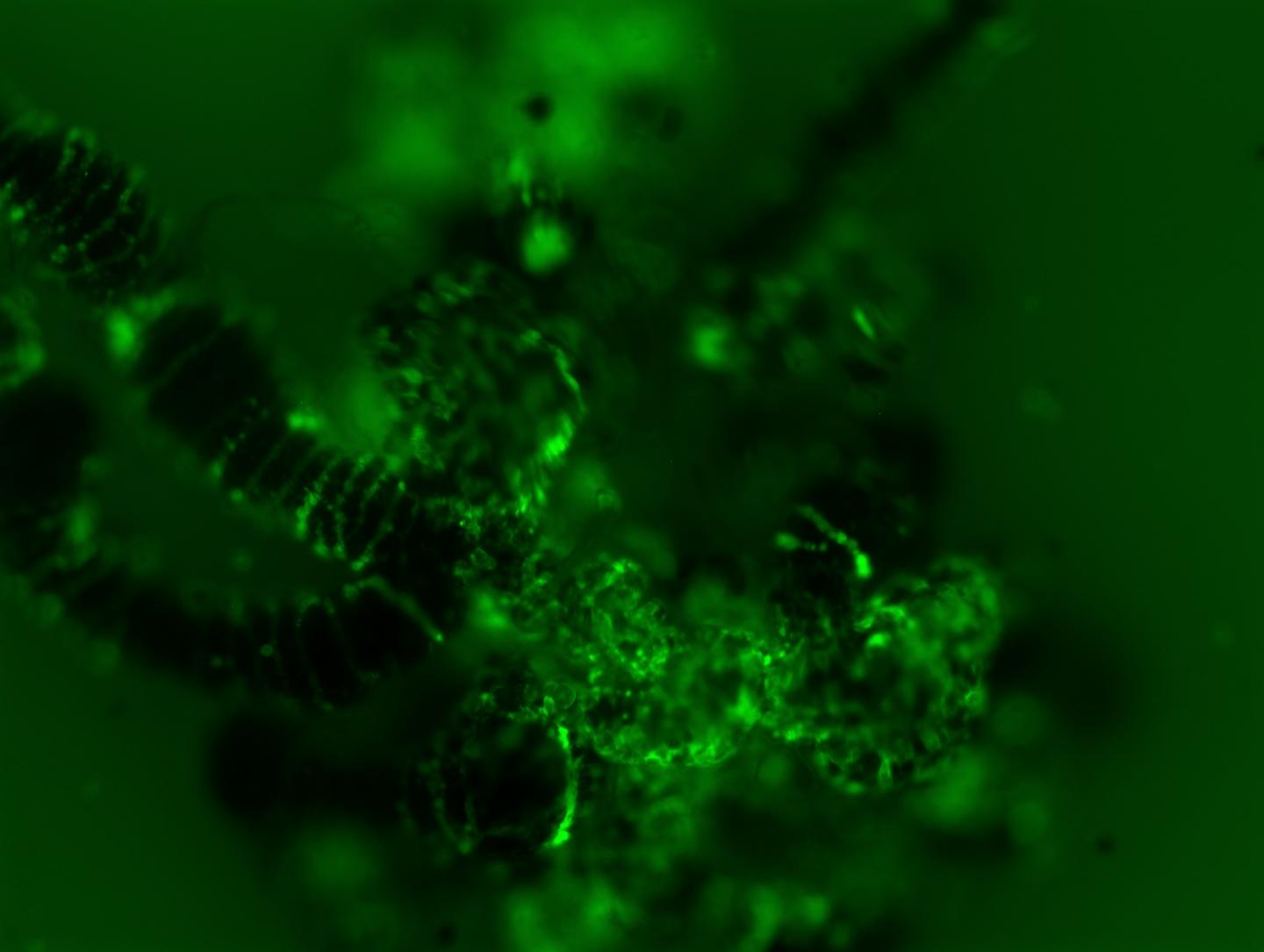 Langat Virus Fnfection in the Tick Midgut is Shown at 6 Days After Infection