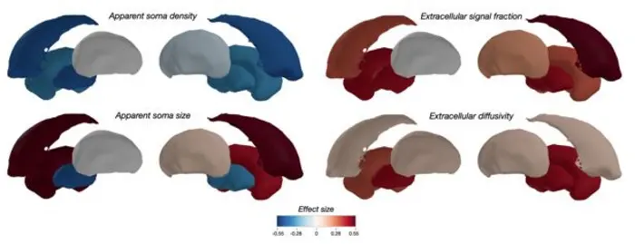 3D brain reconstructions