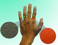 Researchers Discover Nanoparticles Could Prevent Allergic Reaction to Nickel (2 of 2)