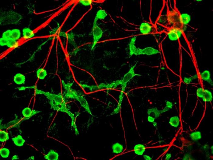 How does environmental enrichment (EE) improve functional recovery after stroke?