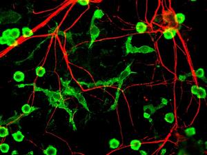 How does environmental enrichment (EE) improve functional recovery after stroke?
