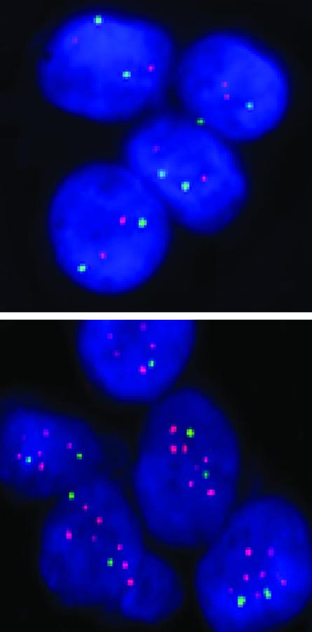 Breast Cancer Cells
