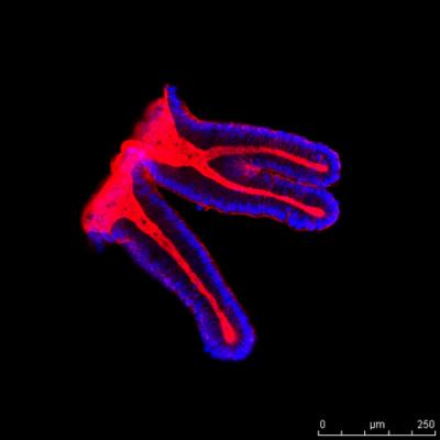 Colon Epithelial Cells