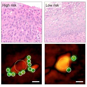 D3 System for Molecular Tumor Profiling