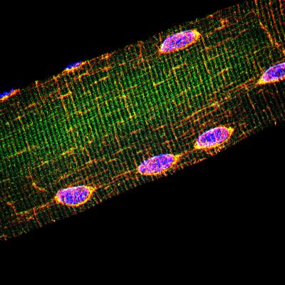 Muscle Fiber Nuclei