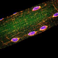 Muscle Fiber Nuclei