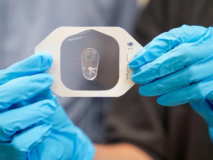 sensor is capable of measuring and reporting the chloride ion levels of a subject's sweat
