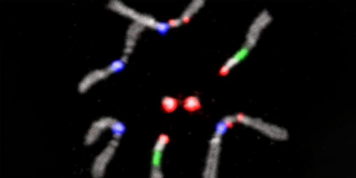 Chromosome Pairs
