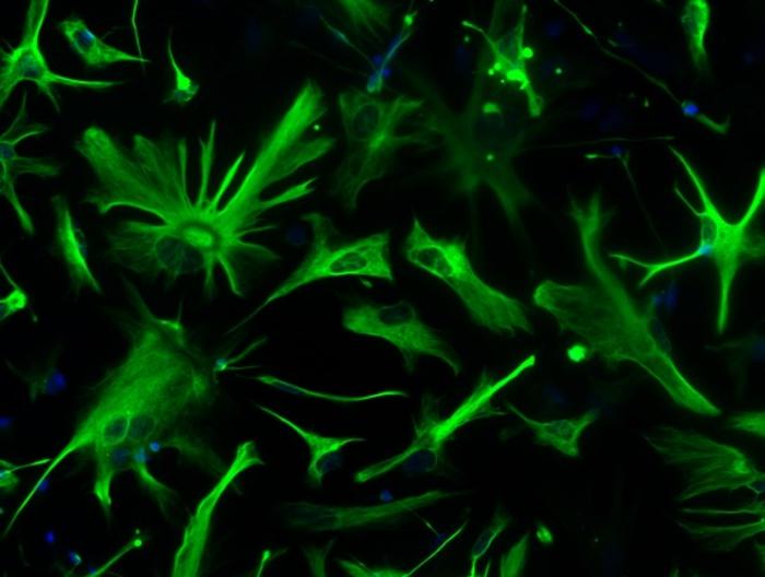 Discover a new ‘cellular target’ to understand and treat alzheimer’s disease