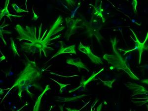 Discover a new ‘cellular target’ to understand and treat alzheimer’s disease