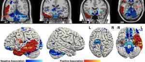 Associations of brain structure with psychopathy