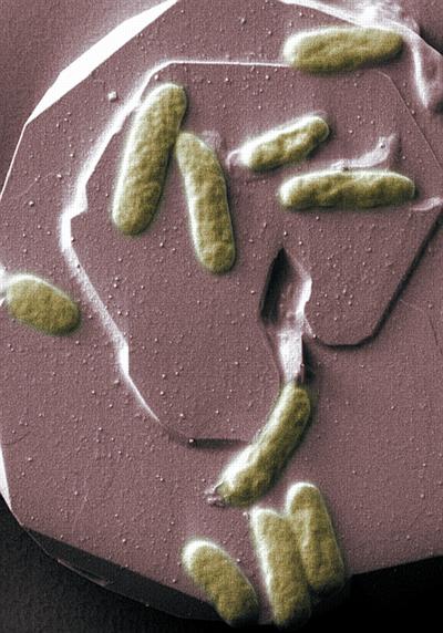 Microbe of Metal