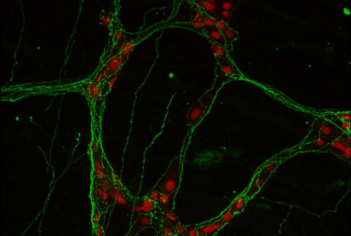 Neurons (red) in the enteric nervous system contain ADM2 (green) along their nerve fibers