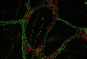 Neurons (red) in the enteric nervous system contain ADM2 (green) along their nerve fibers
