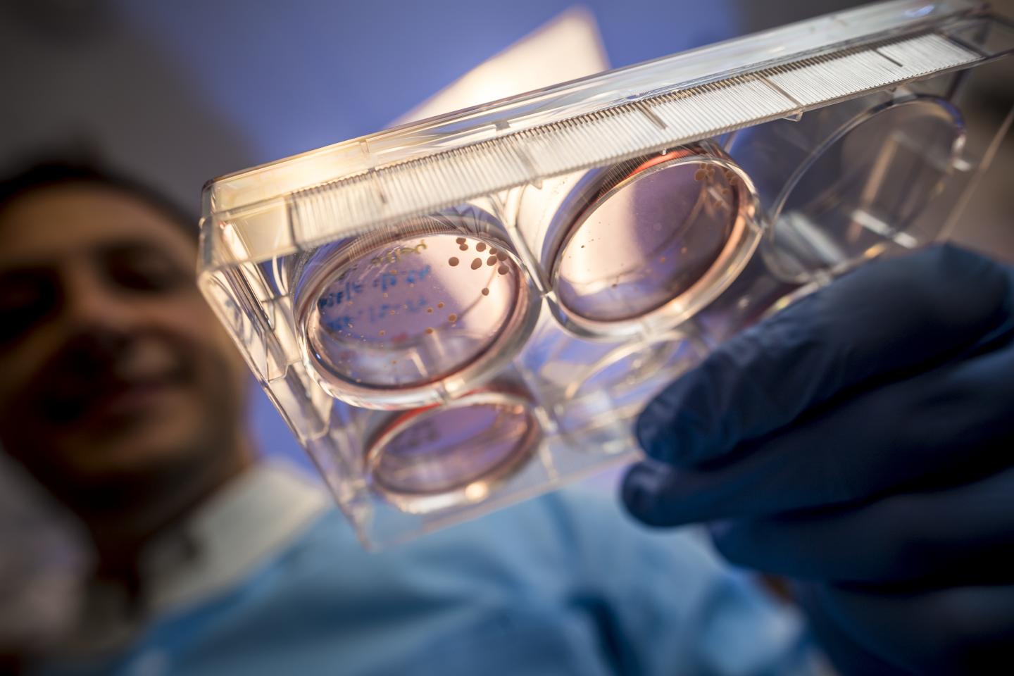 Brain organoids