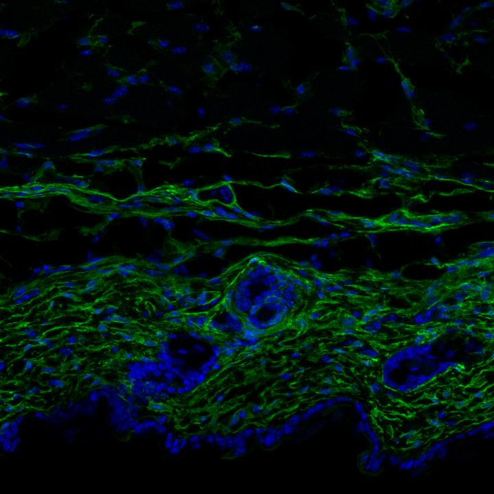 Skin of Young Mouse