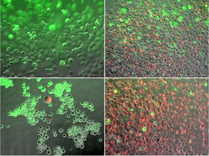 Combination Heating and Freezing Kills Pancreatic Cancer Cells