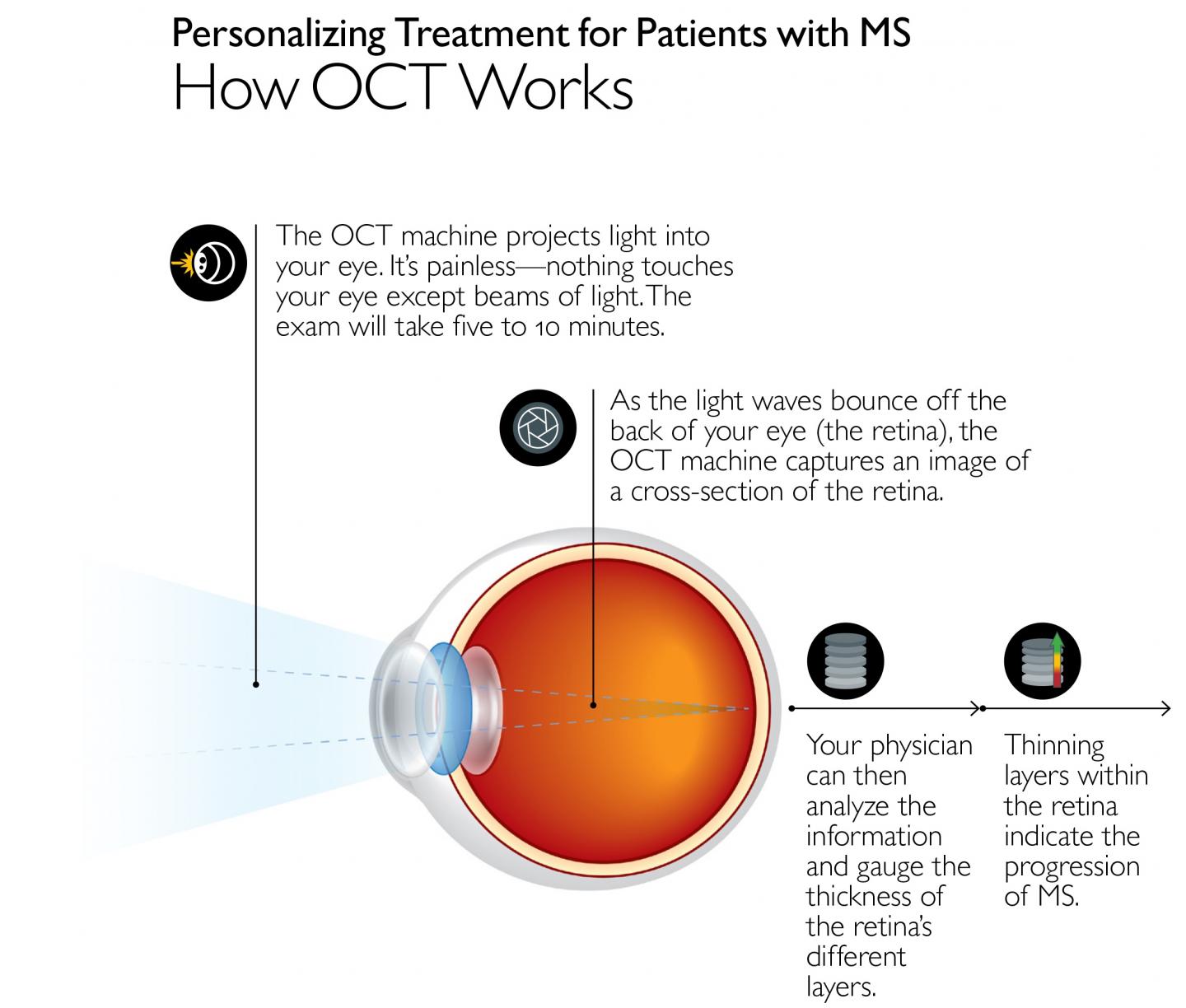 Optical Coherence Tomography