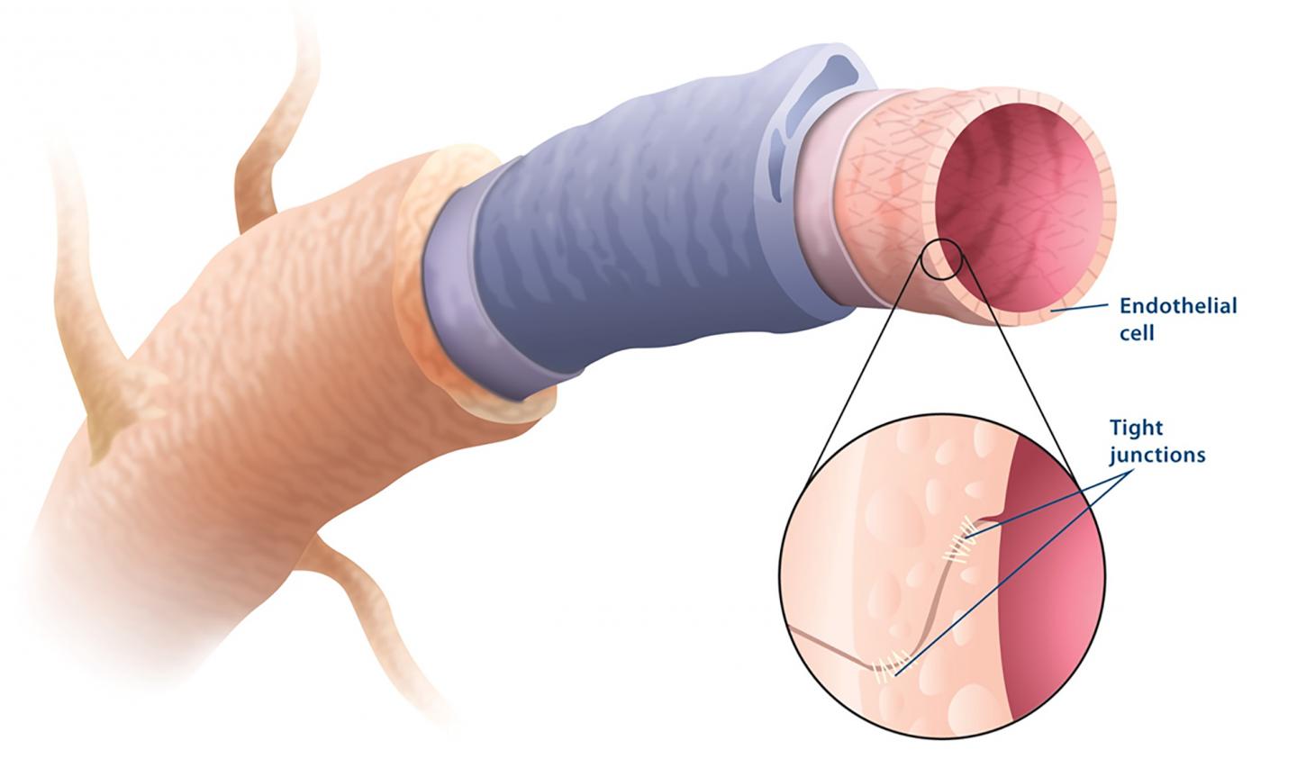 Uncovering a Way for Amyloid to Exit the Brain (2 of 6)