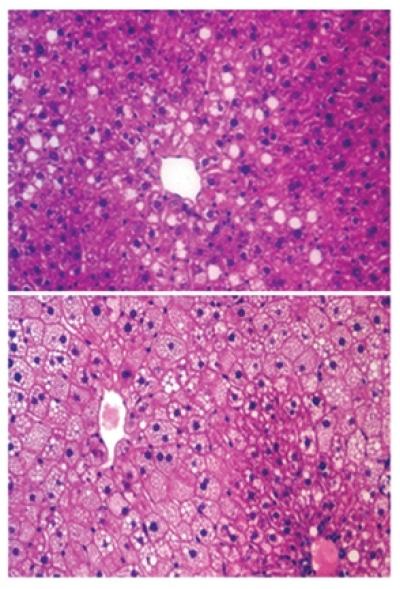 Liver Fat Gets a Wake-Up Call