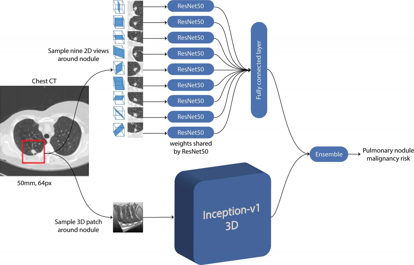 AI Predicts Lung Cancer Risk