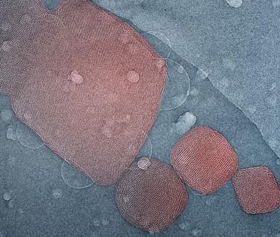 Electron Microscope Image