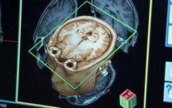 Computerized Image of a Brain
