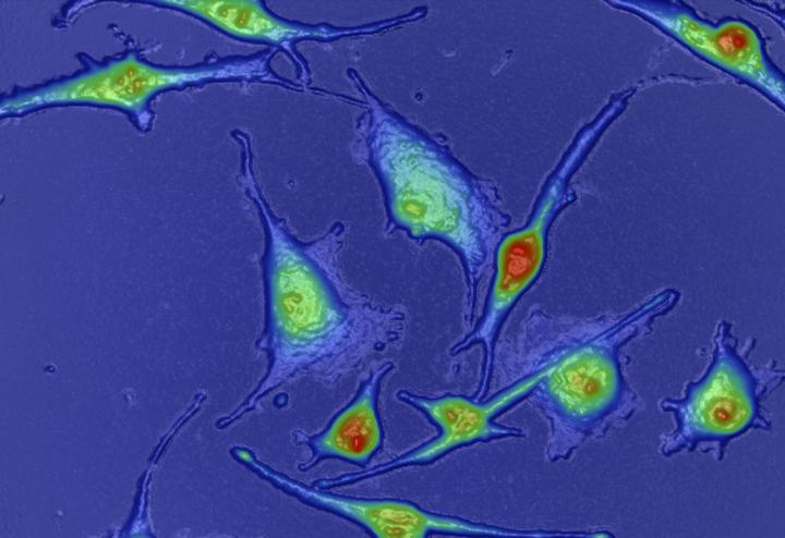 HSLCI Melanoma Cell