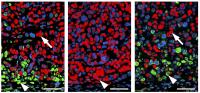 Treatment with MAPK Inhibitor Only Kills Some Colon Cancer Cells in Mice