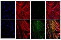 Image of Muscle Cells with and without Dystrophin