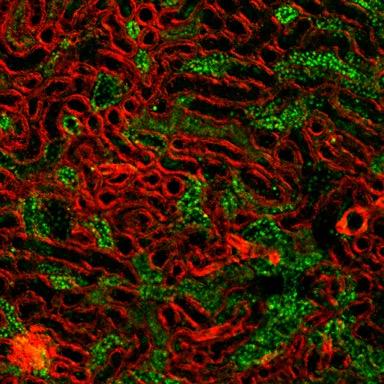 Renal Tissue 
