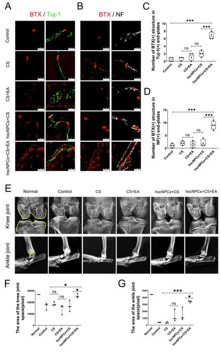 Electroacupuncture Combined with Spinal Neural Cell Transplantation Synergistically Promotes Nerve Regeneration and Functional Rehabilitation After Spinal Cord Injury
