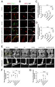 Electroacupuncture Combined with Spinal Neural Cell Transplantation Synergistically Promotes Nerve Regeneration and Functional Rehabilitation After Spinal Cord Injury
