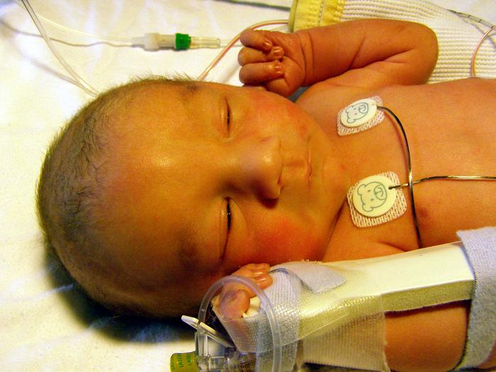 Unique computational framework for robust, real-time HRV monitoring in neonates and critical care patients