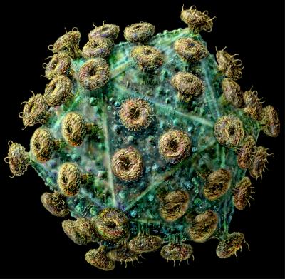 Lost Immune Cells, Invading Bacteria in HIV (3 of 3)