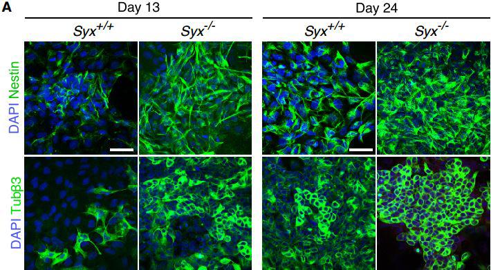 Molecular Brakes on Stem Cell Fate Uncovered