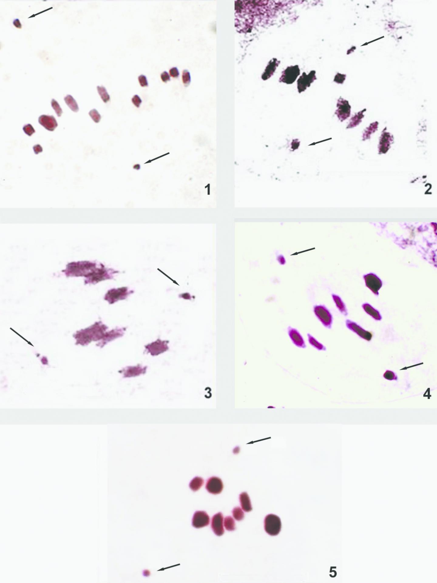 Chromosomes