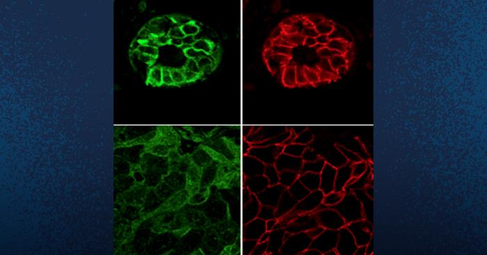 Breast Cancer Cells