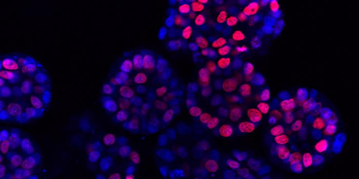 Mini-Tumors Reveal New Drug Combinations for Liver Cancer