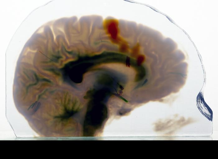 Robert MacCurdy - 3D printed brain